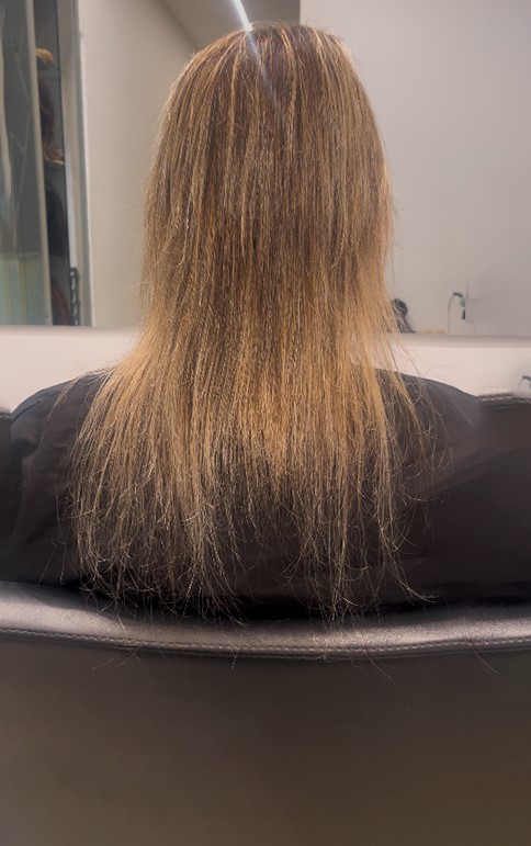 Antes
