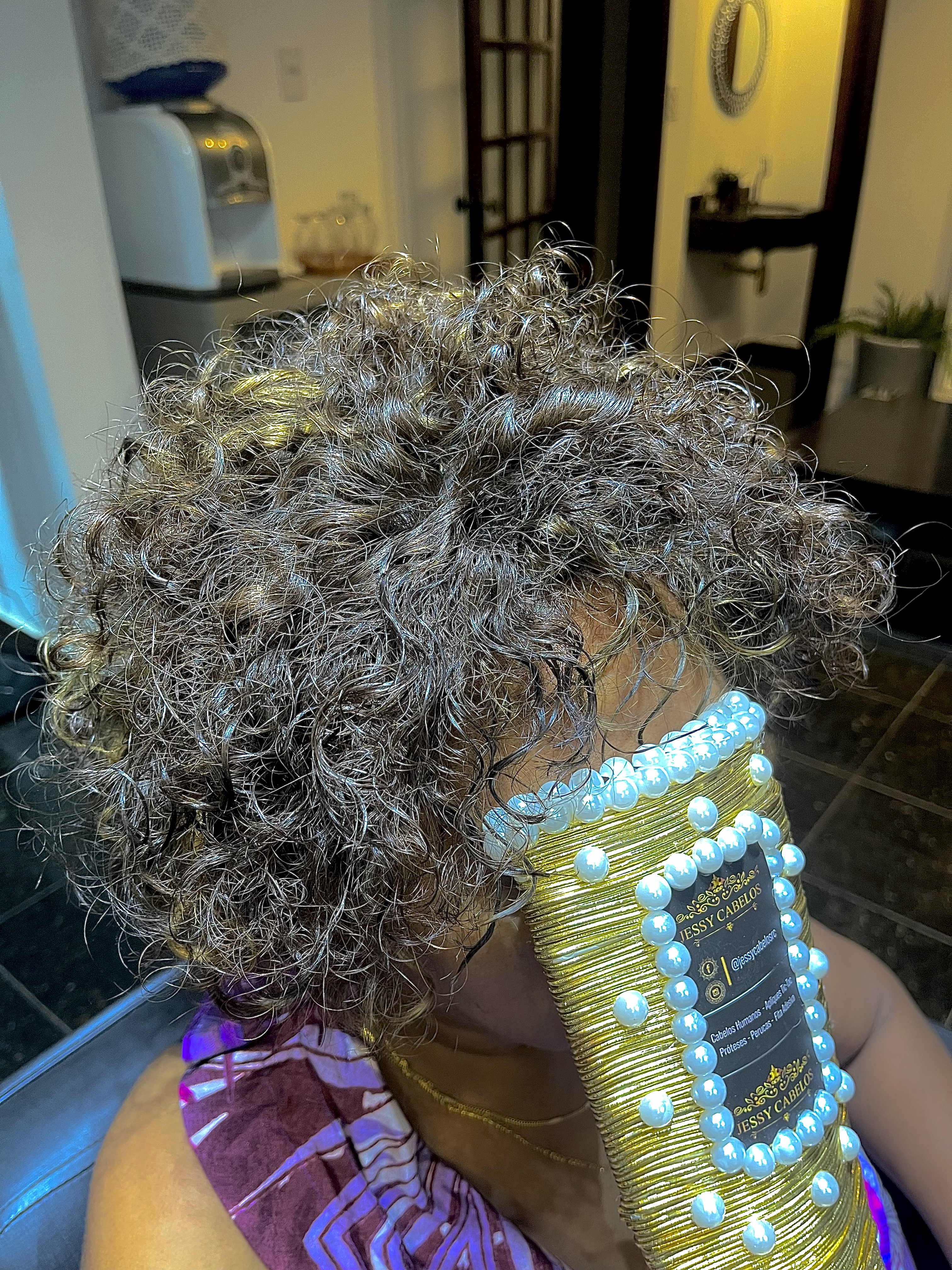 Alopecia resultado